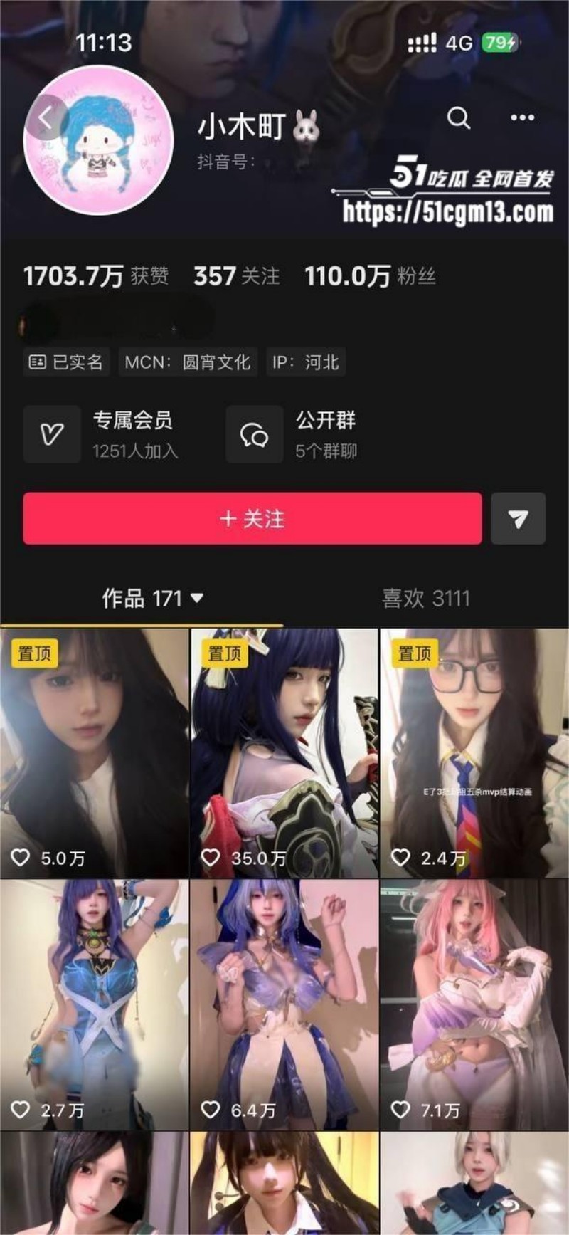 抖音高颜值萝莉 小木町 大尺度福利自拍