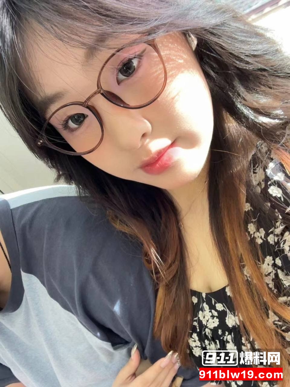 医学博士张娅儿6