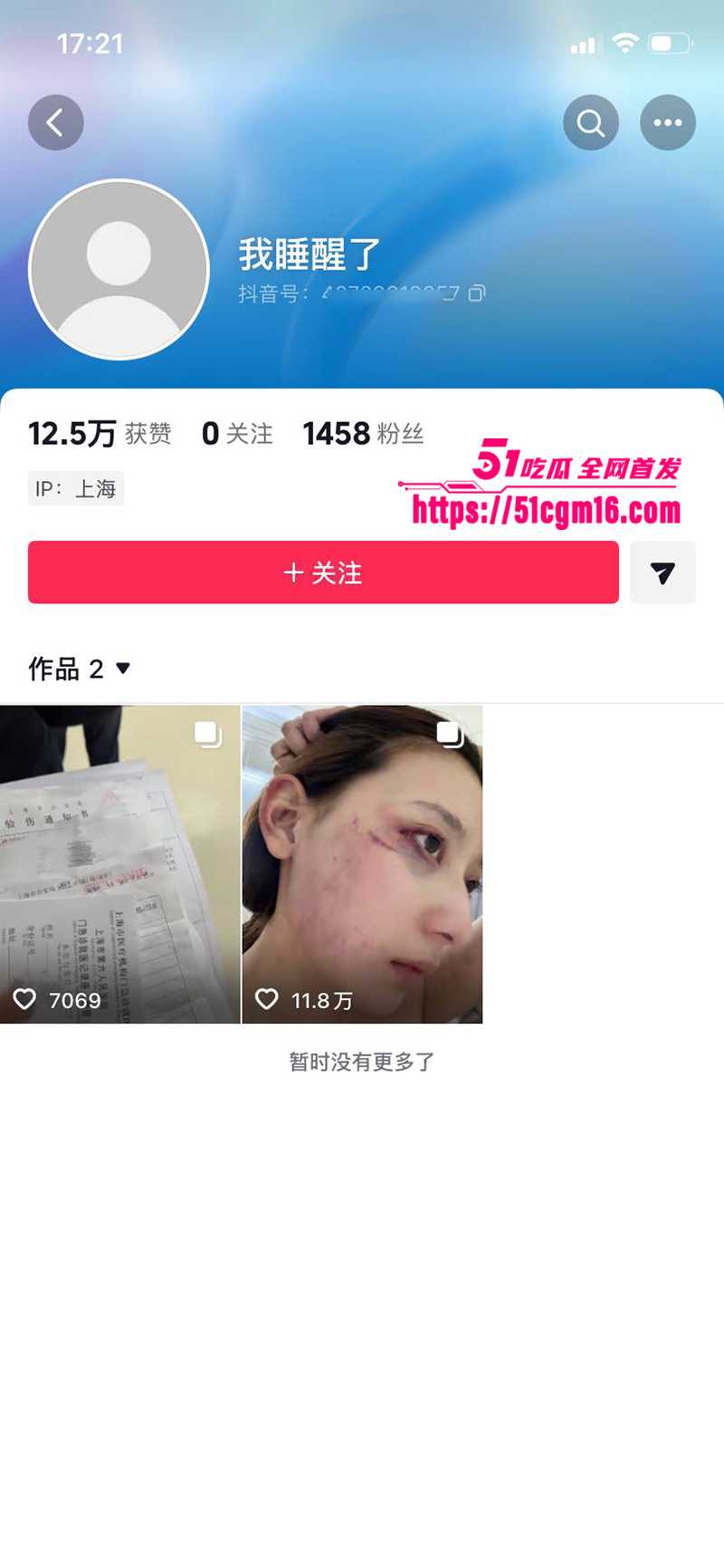 千万大V张百乔家暴视频被扒 1 拷贝