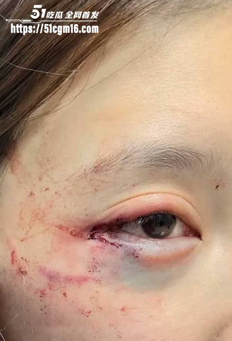 千万大V张百乔家暴视频被扒 32 拷贝