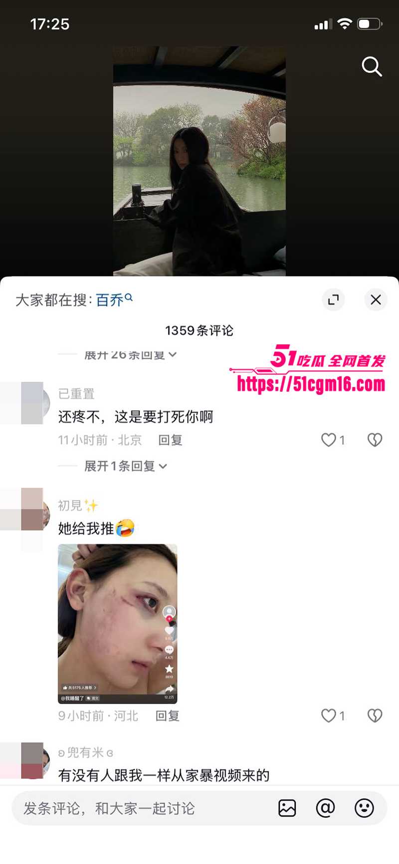 千万大V张百乔家暴视频被扒 20 拷贝