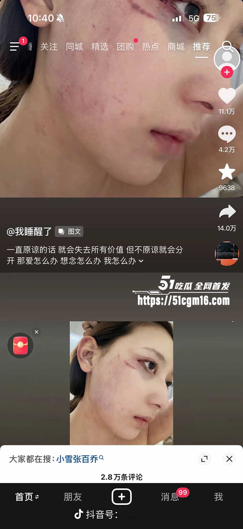 千万大V张百乔家暴视频被扒 28 拷贝