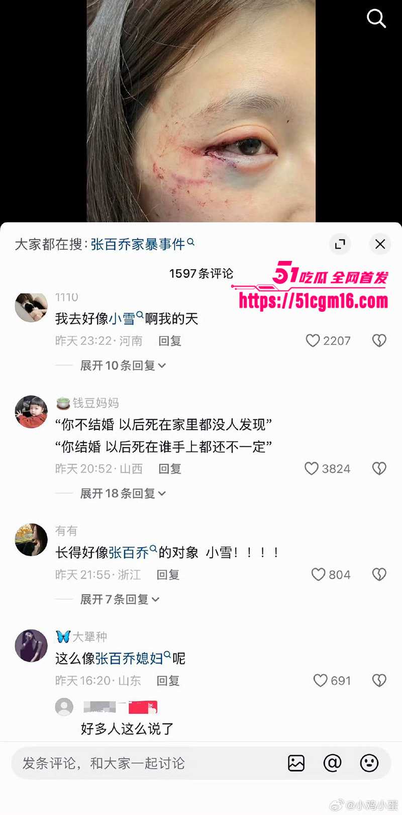 千万大V张百乔家暴视频被扒 23 拷贝