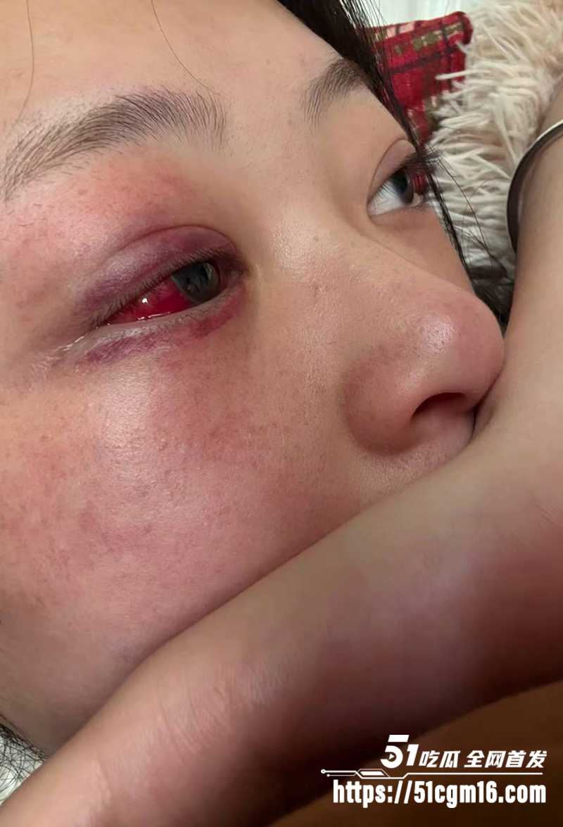 千万大V张百乔家暴视频被扒 30 拷贝