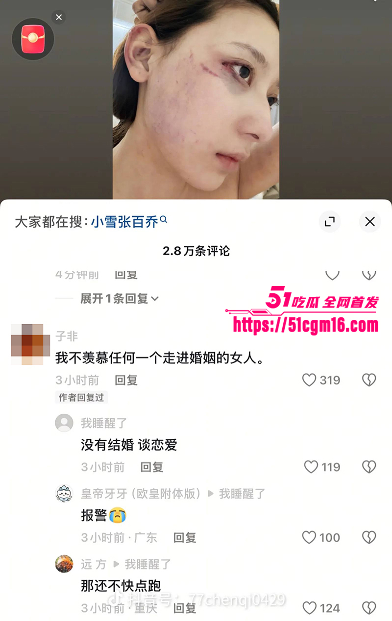 千万大V张百乔家暴视频被扒 22 拷贝