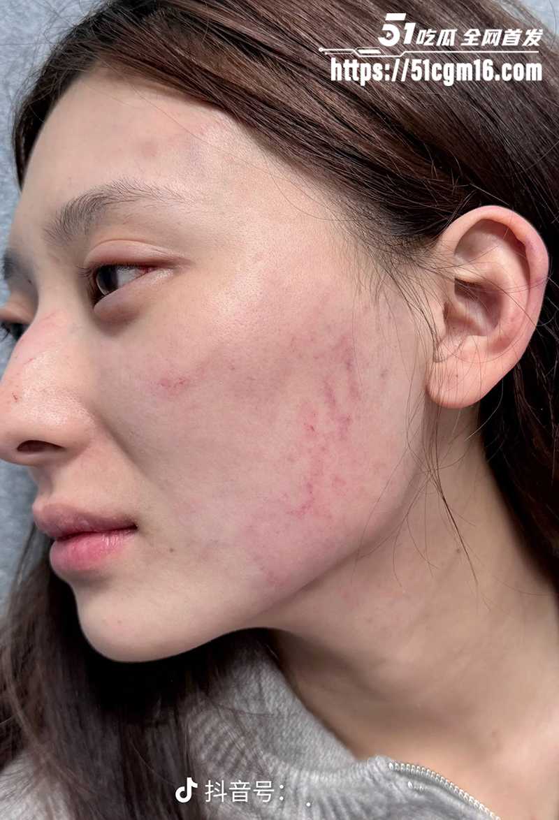 千万大V张百乔家暴视频被扒 31 拷贝