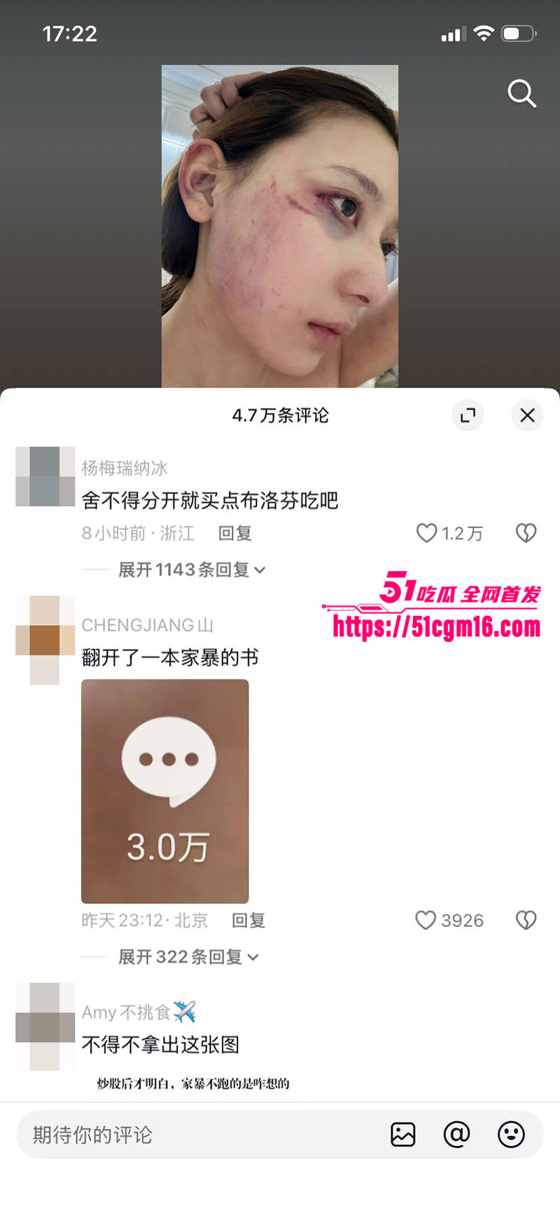 千万大V张百乔家暴视频被扒 21 拷贝