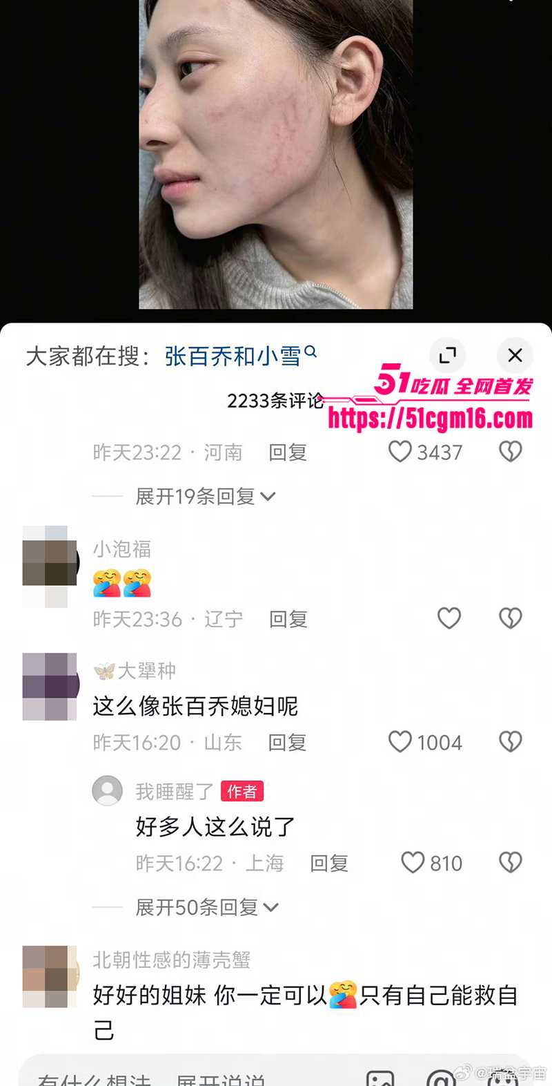 千万大V张百乔家暴视频被扒 24 拷贝